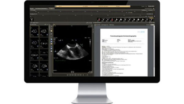 Cardiology informatics